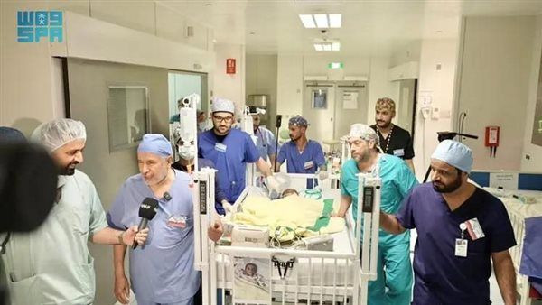 التوأم السيامي النيجيري  حسنة وحسينة