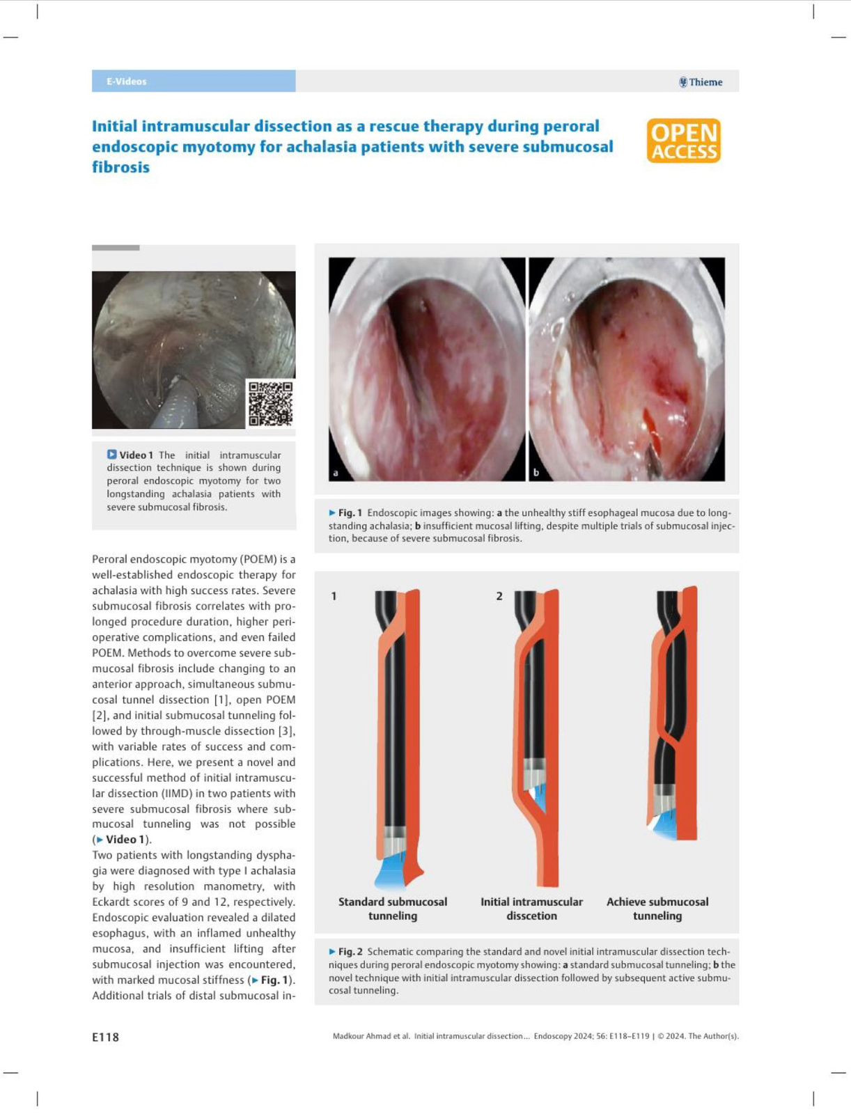 تقنية مدكور